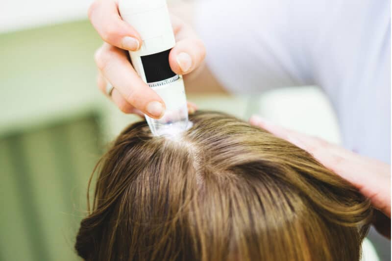 scalp treatments for ageing scalp